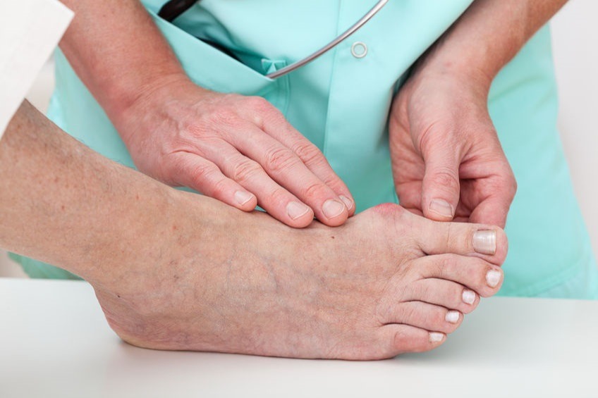Diabetic Foot Treatment